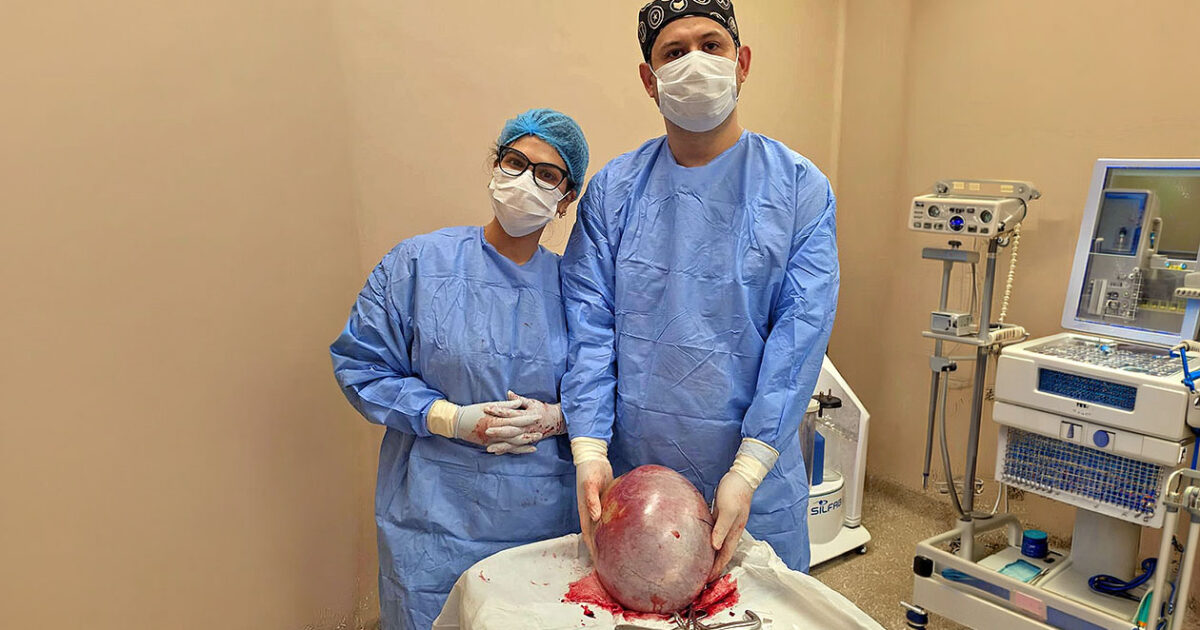 Extirparon un quiste de ovario de 7,6 kilos en el Hospital Distrital de Presidente Franco