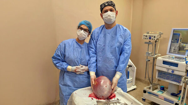 Extirparon un quiste de ovario de 7,6 kilos en el Hospital Distrital de Presidente Franco