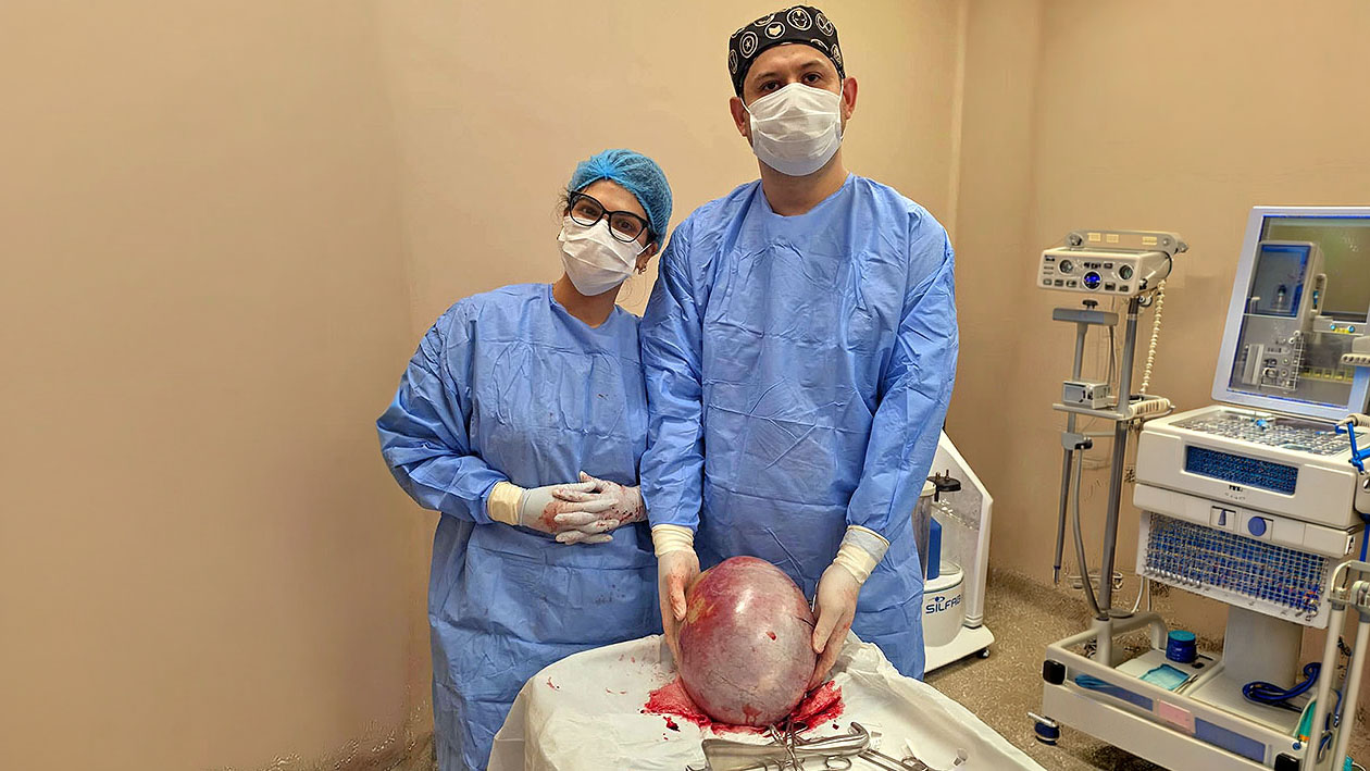 Extirparon un quiste de ovario de 7,6 kilos en el Hospital Distrital de Presidente Franco